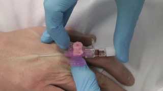 Cannulation How to gain IV access [upl. by Laris]