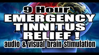 TINNITUS RELIEF Violet Noise  Neuromodulation  Visual Stimulus [upl. by Amelus]