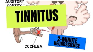 2Minute Neuroscience Tinnitus [upl. by Mail241]